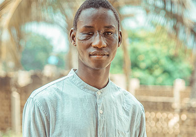 Young man with injured face
